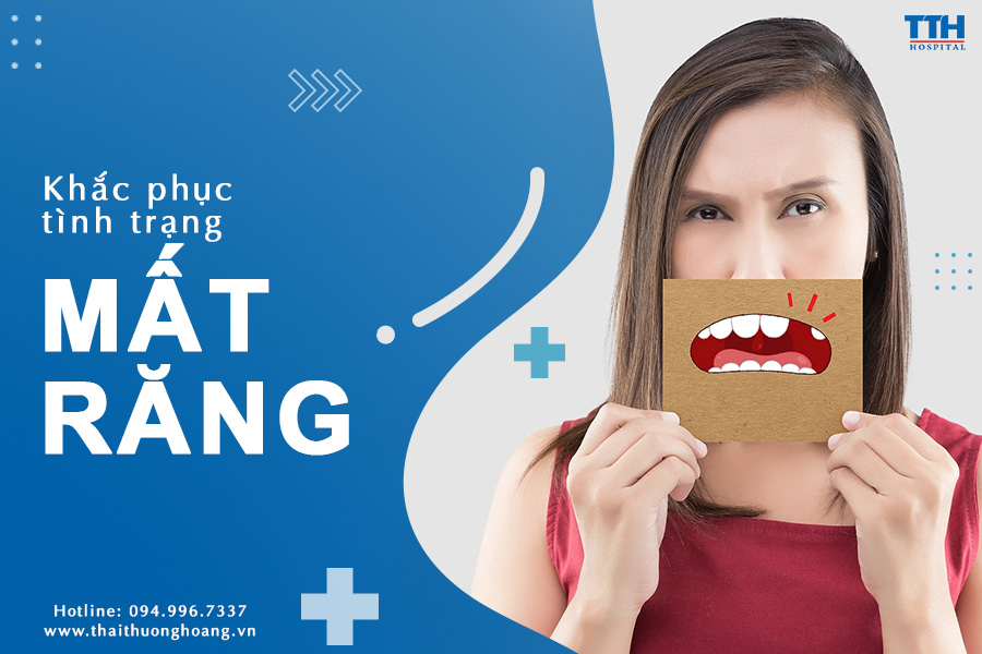 KHẮC PHỤC TÌNH TRẠNG MẤT NHIỀU RĂNG